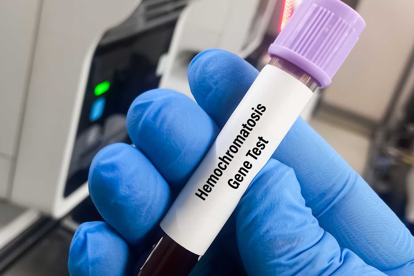 ferritine-elevee-et-stress-2